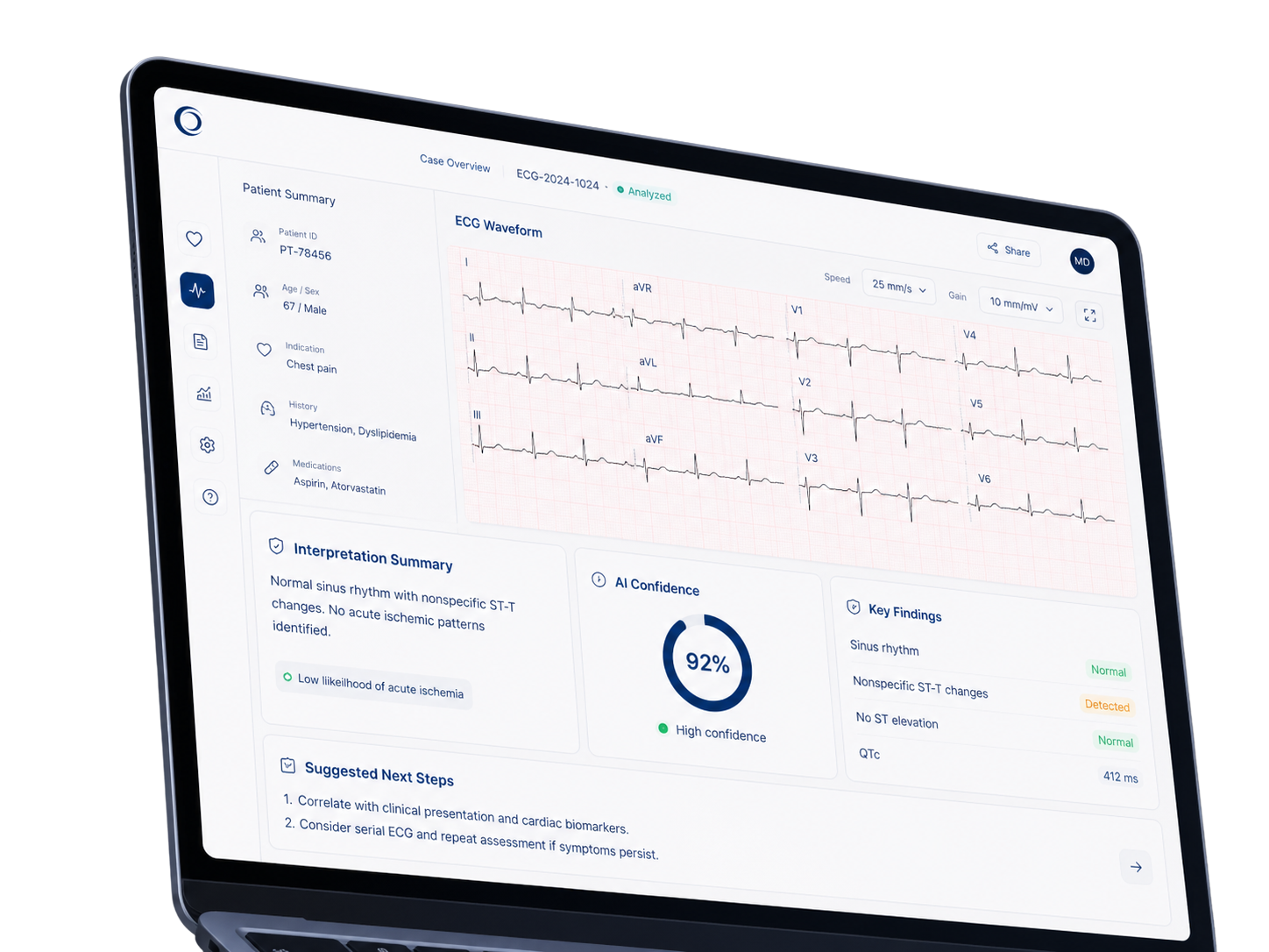 Example of a CLARA ECG interpretation report